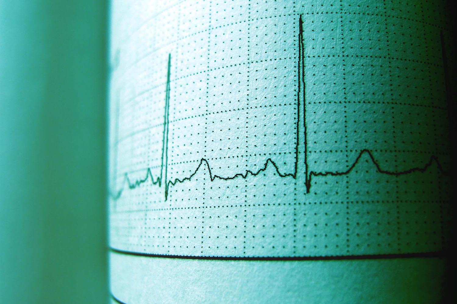 electrocardiograma